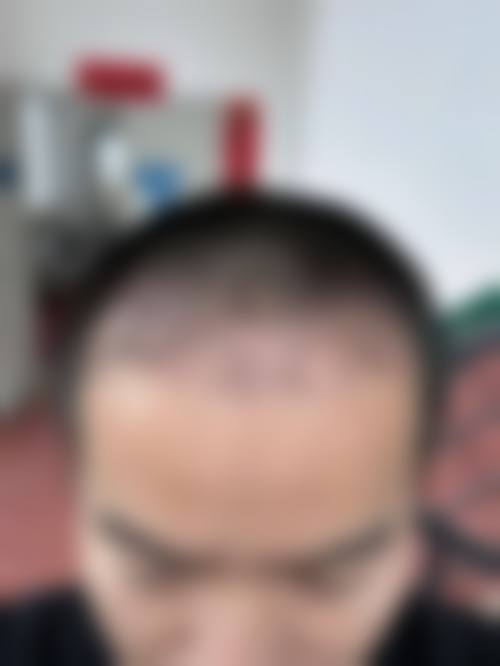 四、南阳仁康医院医疗美容科实例