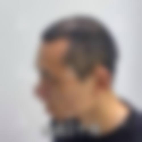 六、南阳仁康医院医疗美容科价格表:(仅供参考)