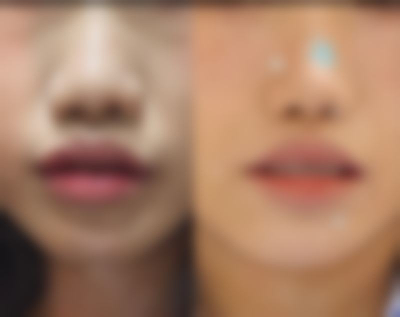 潘风华医生怎么样可靠吗?