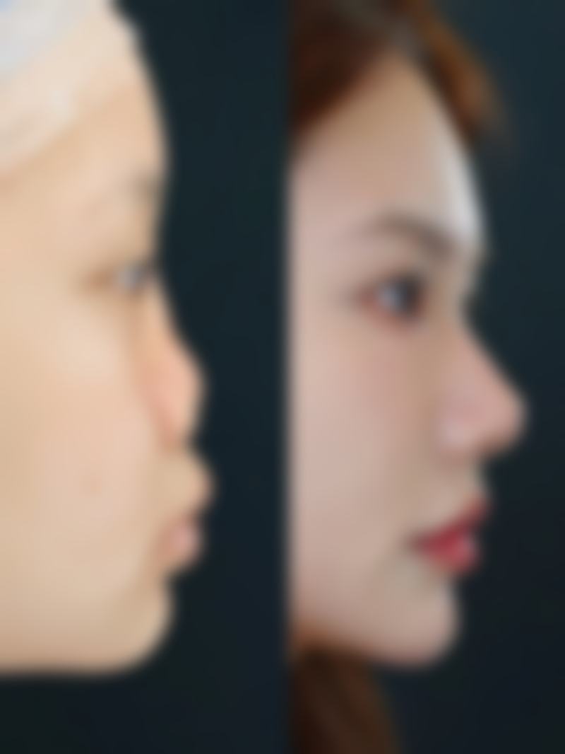 五、韩国O&YOUNG整形外科实例