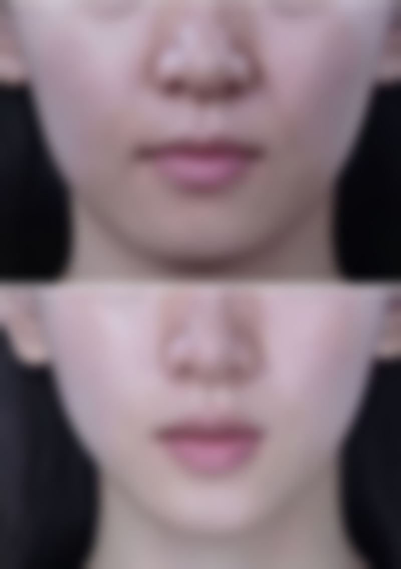 五、绵阳韩美医疗整形美容门诊部实例