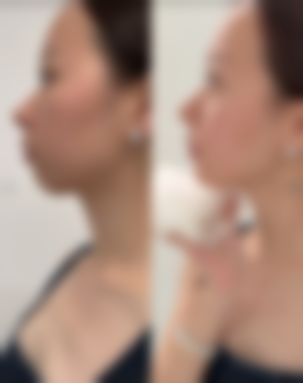 七、韩国O&YOUNG整形外科价格表:(仅供参考)