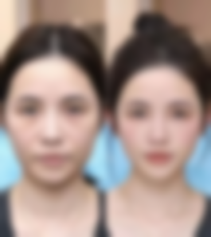 张晓飞医生怎么样可靠吗?