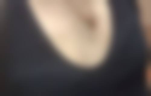 隆胸乳晕切口疤痕明显吗？适配人群大揭秘