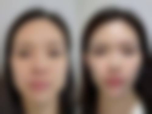 二、烟台润美医疗美容诊所正规吗?来看看医院资质: