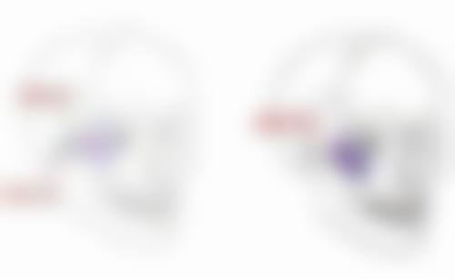 隆胸乳晕切口疤痕明显吗？揭秘隐蔽秘诀，适配人群术后疤痕融合纹理更美观 