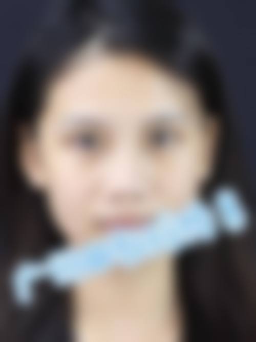 七、札幌Dream美容外科价格表：（仅供参考）