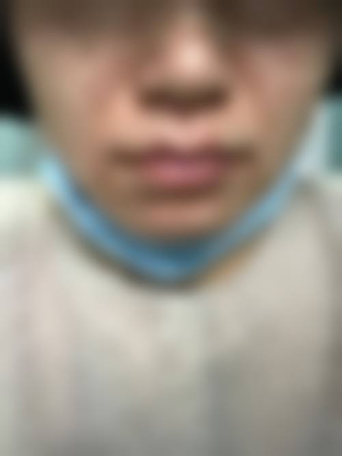 八、札幌Dream美容外科真实的顾客评价如下：