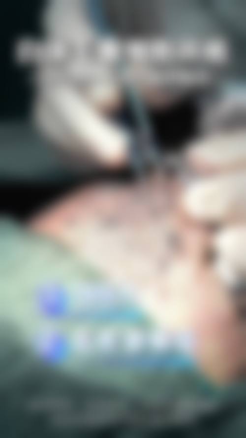 五、福州米兰(毳毛)植发中 心实例