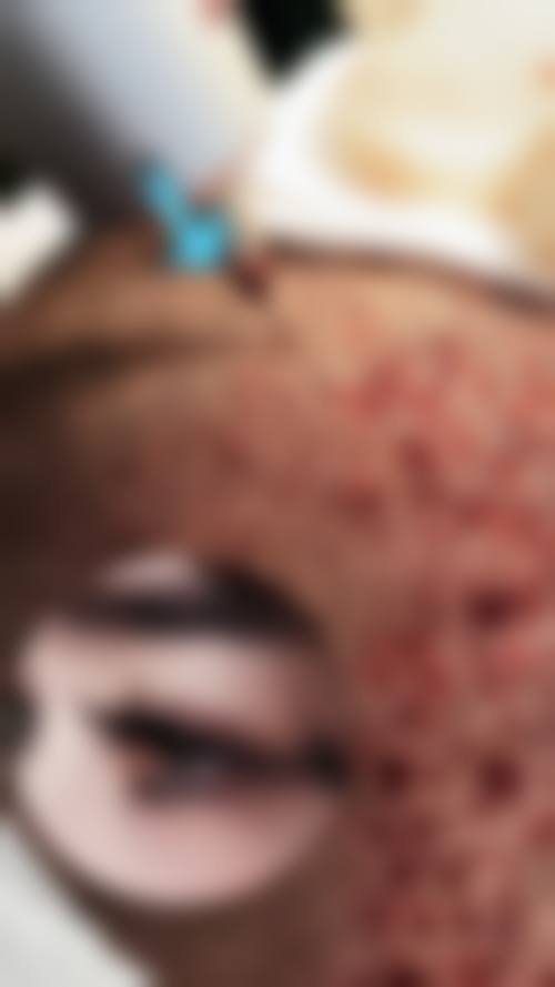 二、福州米兰(毳毛)植发中 心正规吗？来看看医院资质：