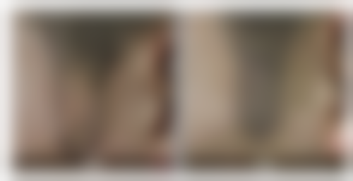 四、福州米兰(毳毛)植发中 心基本信息：