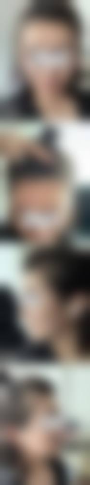 七、福州米兰(毳毛)植发中 心价格表：（仅供参考）