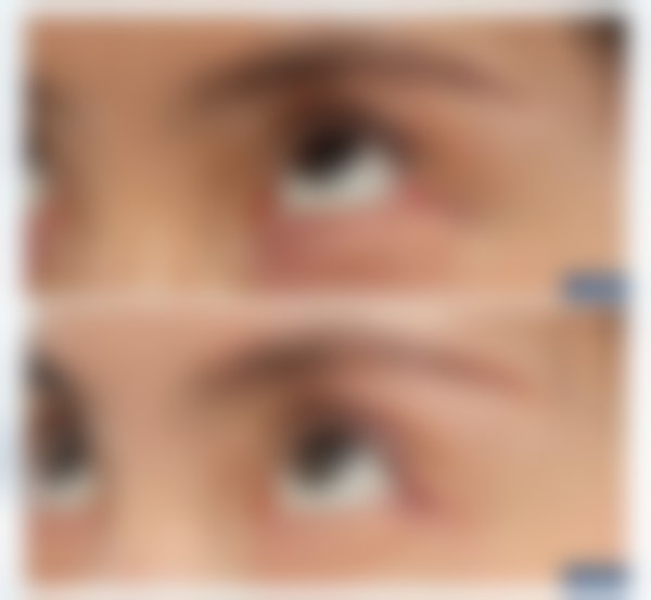 上海爱尚丽格医疗美容门诊部尹轩羽的审美与手术成效