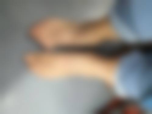 影响瘦脸针注射次数的因素