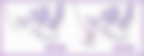 瘦脸针一般打几次合适？2 - 4 次可依个人情况调整，完成周期后维持间隔能延长 