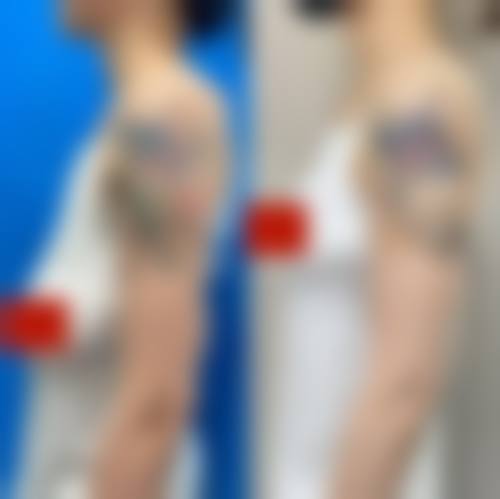 六、台州优颜嘉整形医院价格表：（仅供参考）