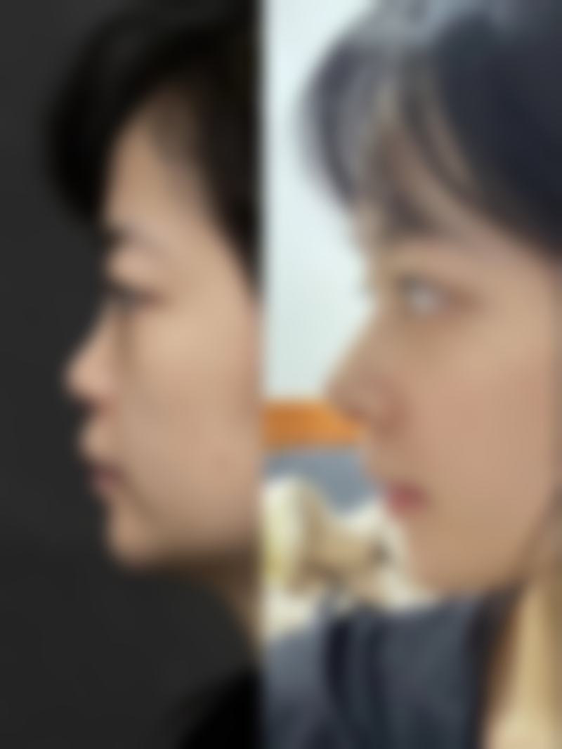 八、杭州艾慕加医疗美容门诊部真实的顾客评价如下: