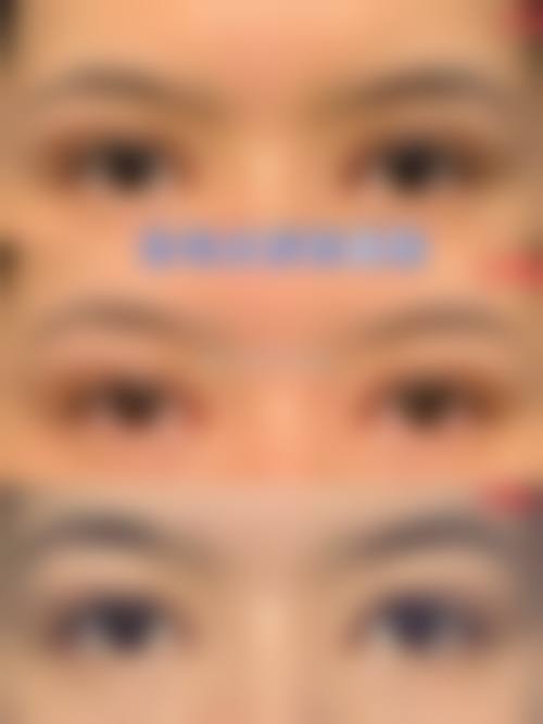 七、渠县整形医院价格表：（仅供参考）