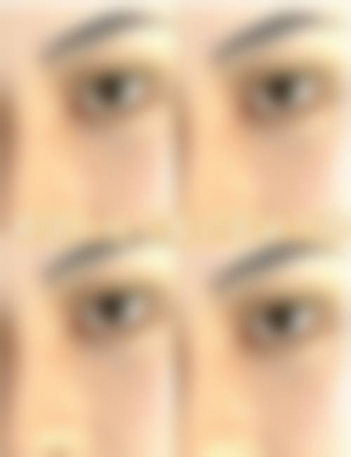 七、内蒙古医学校附属医院激光美容中 心价格表：（仅供参考）