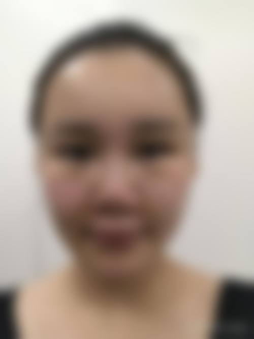 五、郑州赛尔整形医院怎么预约：