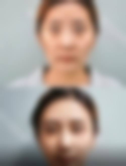 六、郑州赛尔整形医院价格表：（仅供参考）