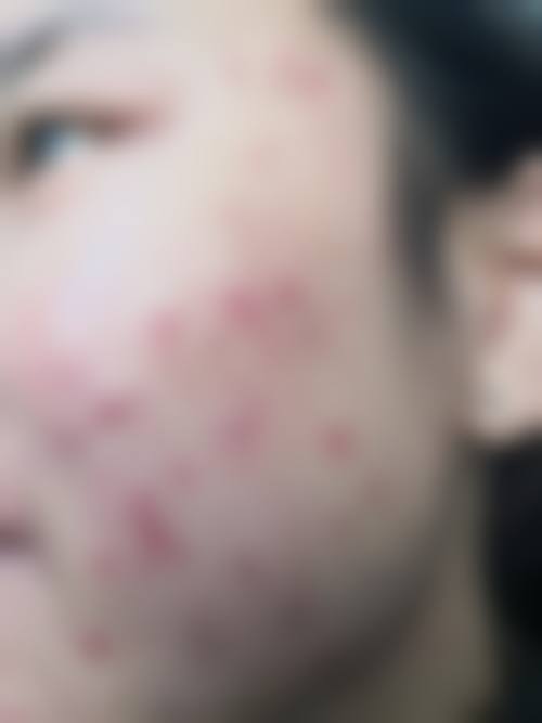 张娟华医生口碑和评价