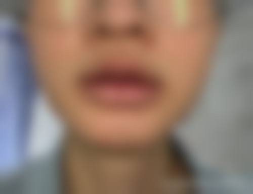 六、龙沙区大千医疗美容诊所价格表：（仅供参考）