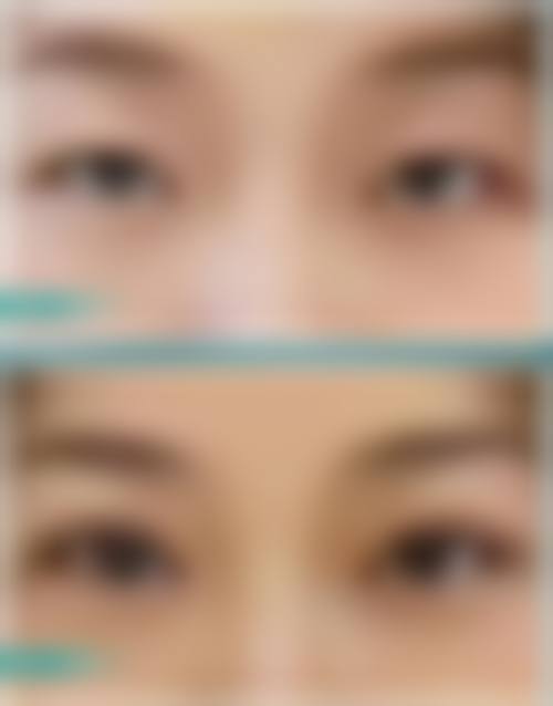 四、郑州赛尔整形医院实例