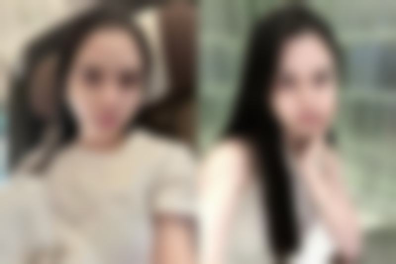 二十多年增生疤痕疙瘩切除，术后辅助治疗有啥用？