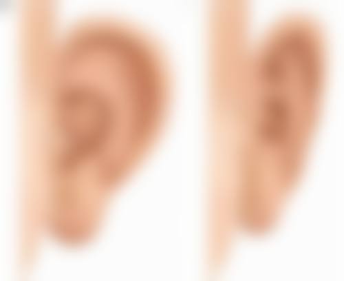 物理治疗：科技助力消除眼袋