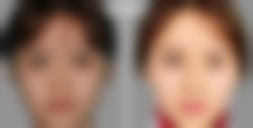 周惠能医生在哪家医院怎么预约？