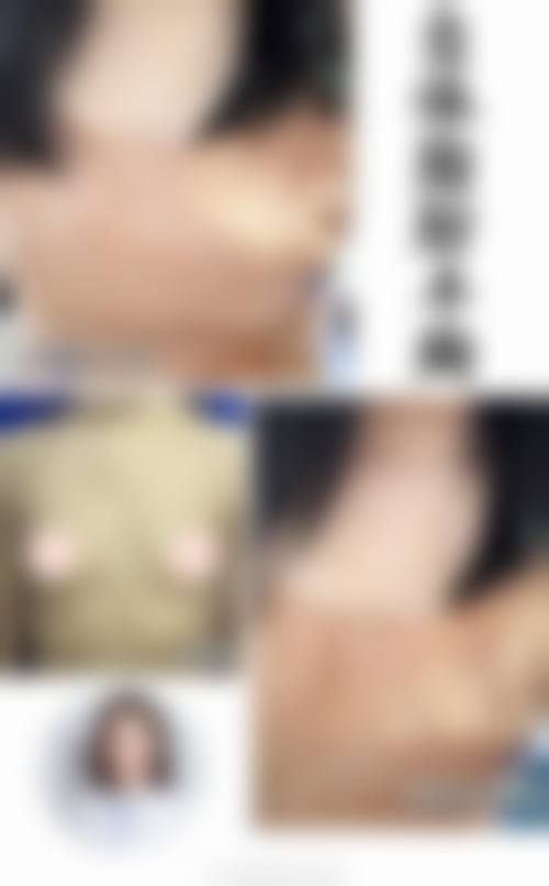 六、能代美容外科怎么预约：