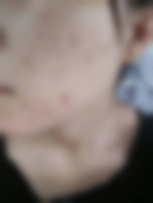 陈道明医生口碑和评价