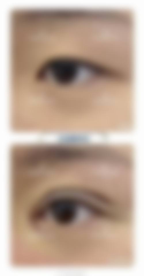 七、中山美咖医疗美容诊所真实的顾客评价如下: