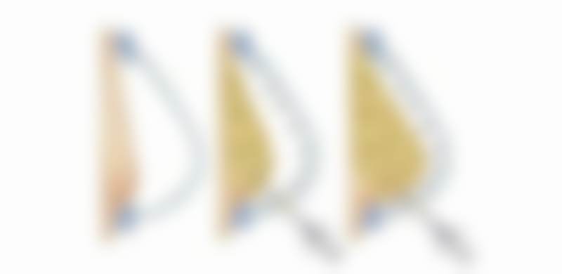 大连爱德丽格医疗美容门诊部刘志刚医生眼部整形5000元起，金刀奖得主打造自然灵动双眸 