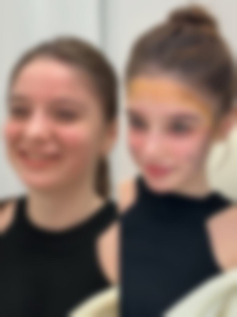 天生下眼袋难消除？多种疗法齐上阵，保守、手术、注射全方位改善！ 