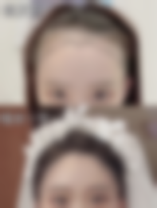 假体隆胸后多久能随心触摸?术后一个月左右触摸情况揭秘