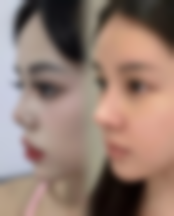 五、成都美极医疗美容门诊部实例