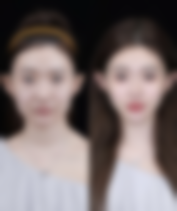 五、常德豆蔻年华整形医院实例