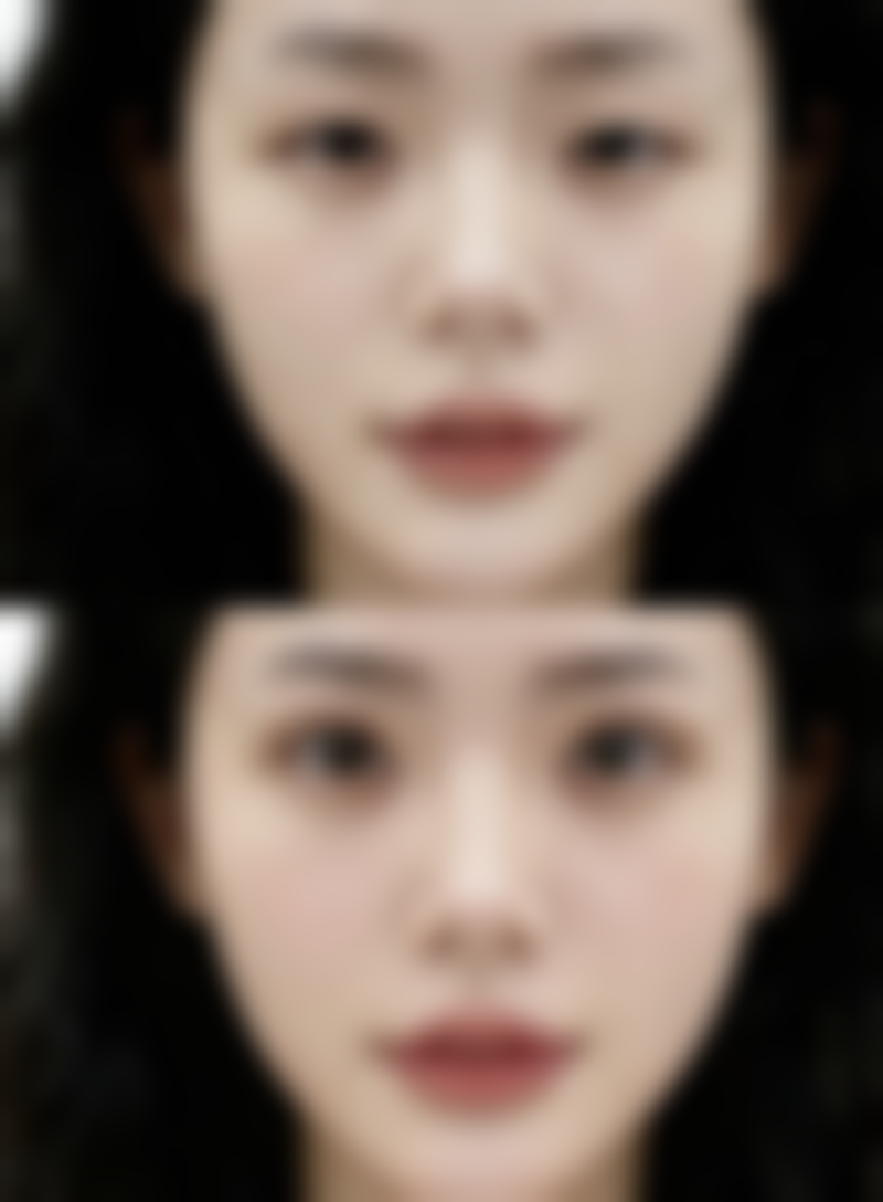 术前术后注意事项：保护治疗成效的关键