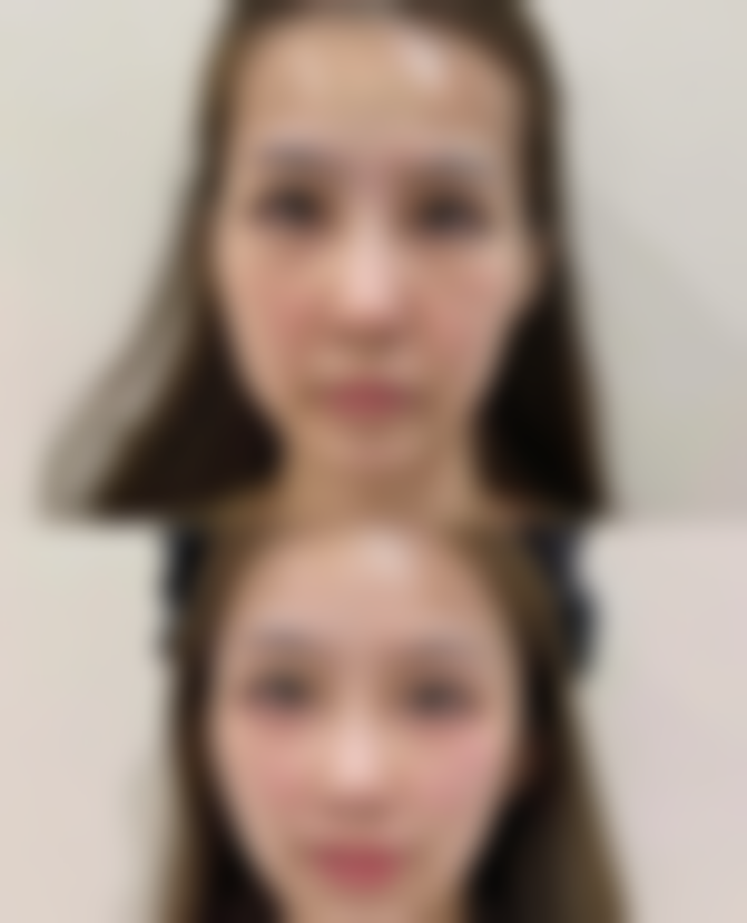 不同医生给出的上班时间建议