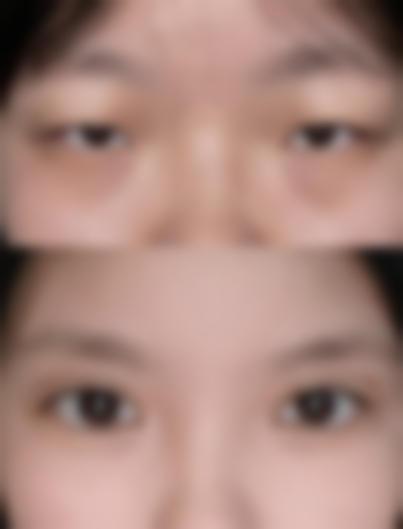 五、青岛市城阳区人民医院整形美容科实例