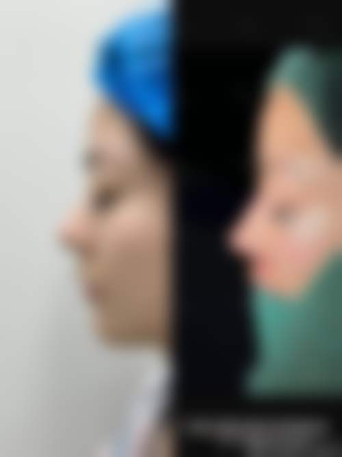 五、宁乡美丽无限整形医院实例