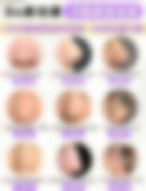 五、柳州花想容整形医院实例