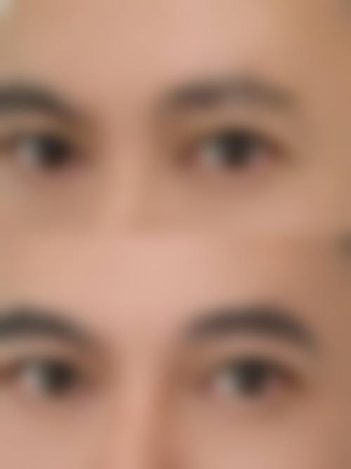 五、北京颜立方整形医院实例: