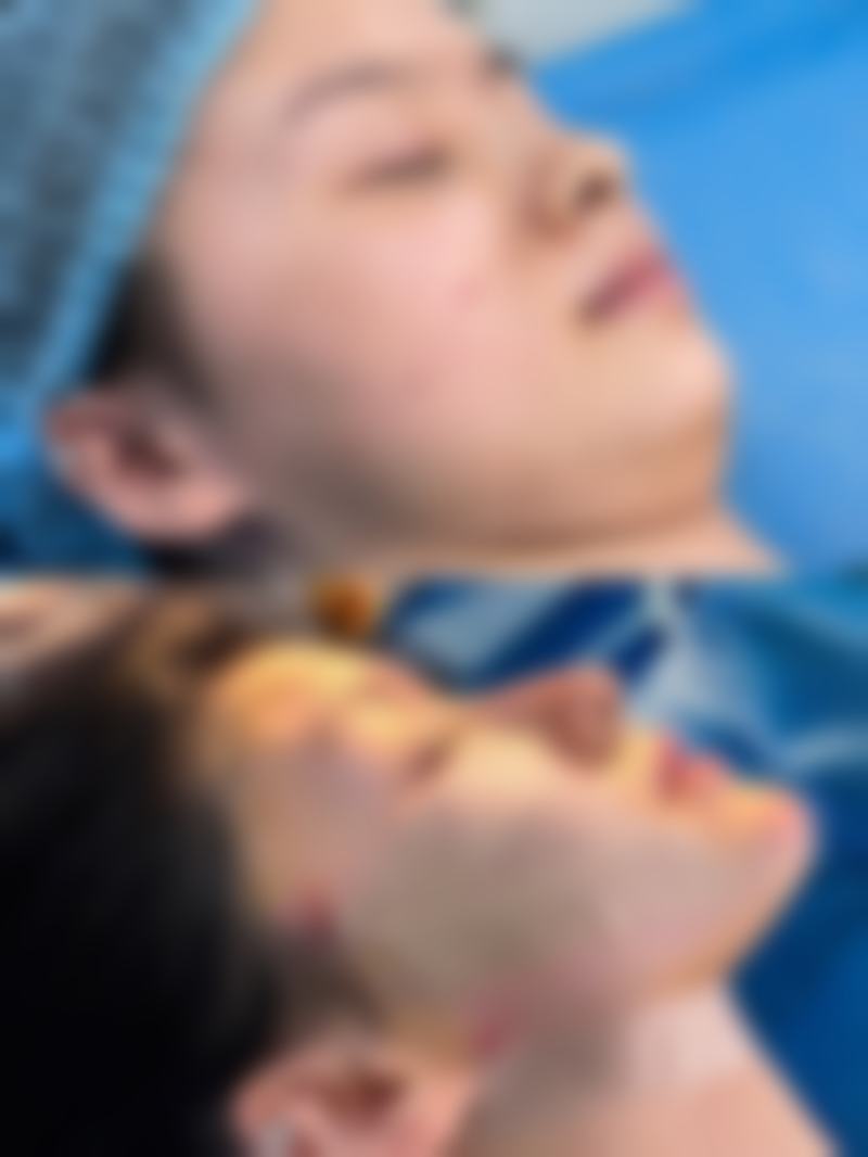 五、韩国可安美（CNM）整形外科实例