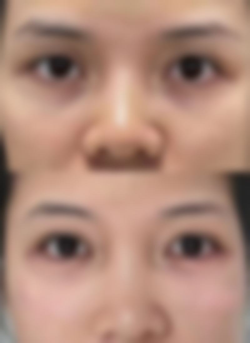 五、合肥奥美整形美容门诊部实例