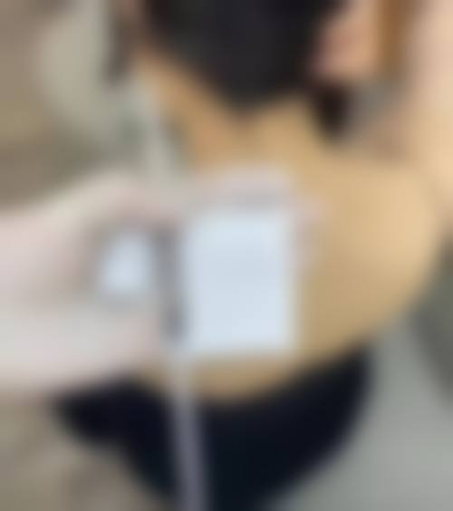 五、昆山东方美人整形医院实例