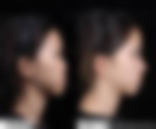 四、上海文峰整形医院开展的主要项目和特色项目