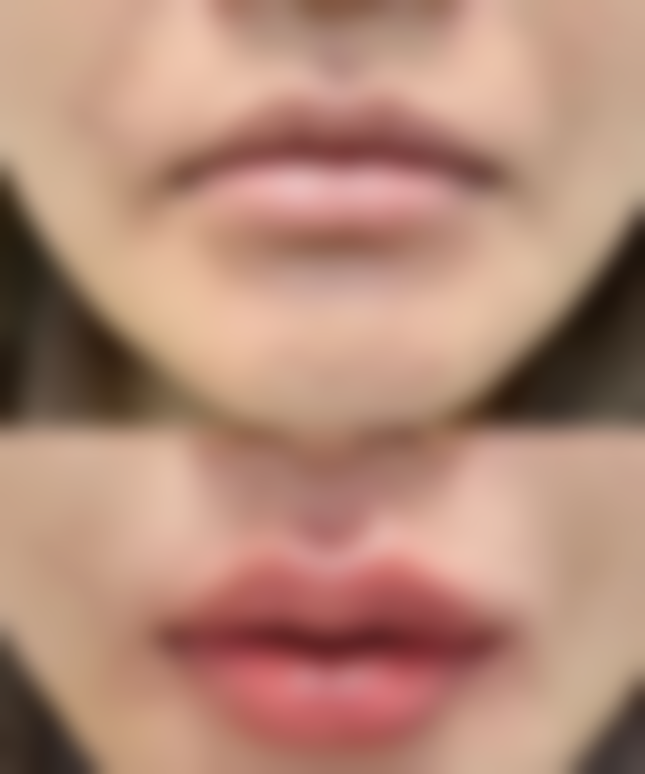 六、茂名贞康医疗美容门诊部怎么预约: